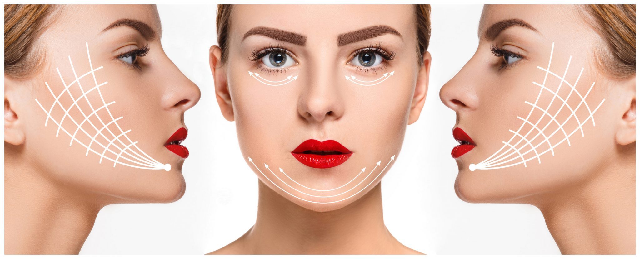 健康・医学 Thread Lifting Techniques Thread Lifting Techniques for Facial Rejuvenation and