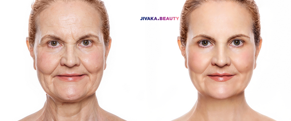 facial-contouring-and-facelift-before-and-after-in-south-korea