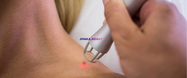 Laser Mole Removal: A Quick Fix for Clearer Skin