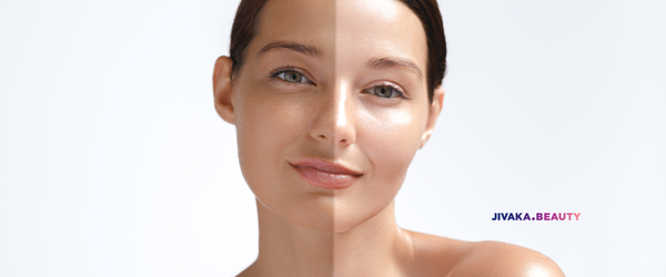 Korean Skin Bleaching Treatment Technology and Results