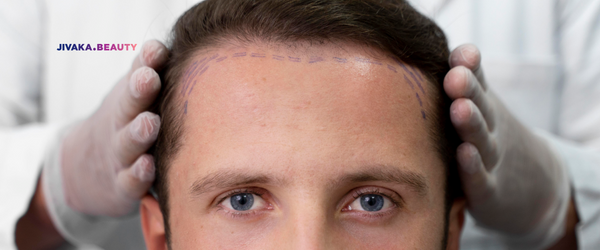 Patient Consulting With a Korean Hair Transplant Specialist During Hairline Design Planning for Natural, Successful Results