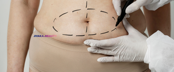 Why-Korean-Tummy-Tuck-Results-Last-Longer-The-Science-Behind-Seoul-Success