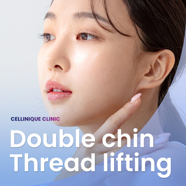 Double Chin Thread Lifting