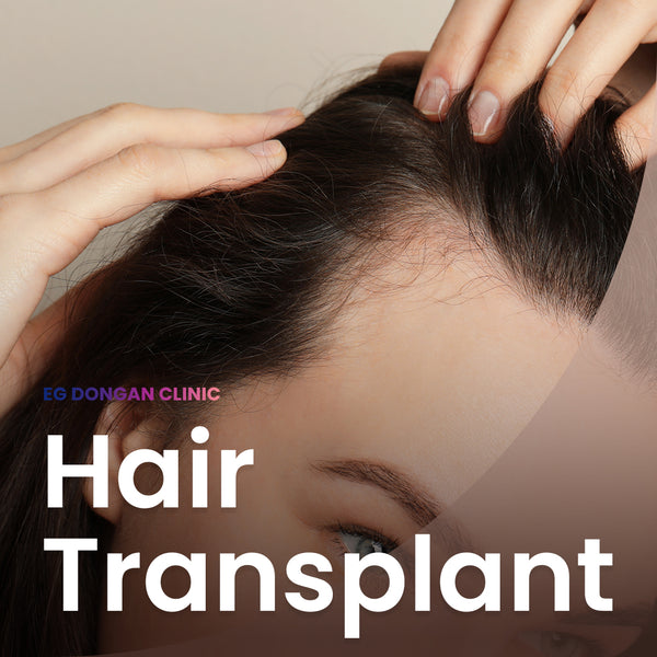 Hair Transplant (1000 Hair Grafts)