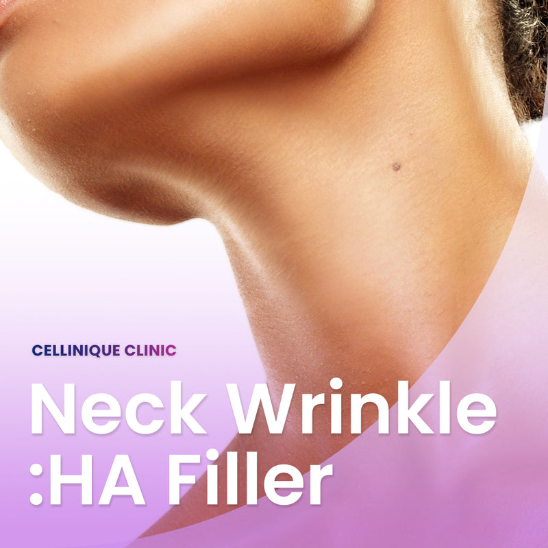 Horizontal Neck Line-Revive (HA filler)