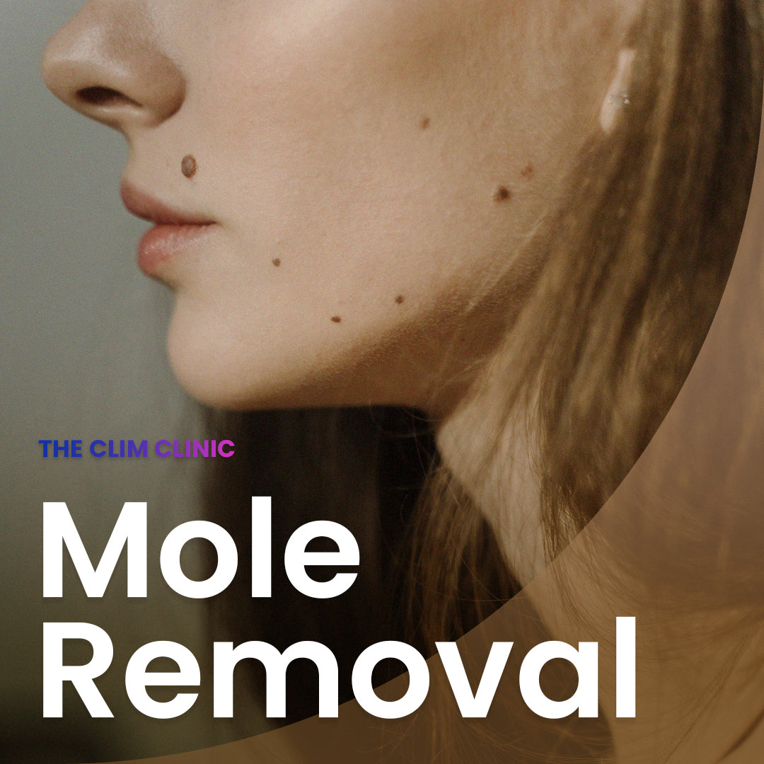 Mole Removal in Myeongdong, Korea - Jivaka Beauty