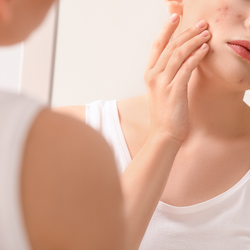 Acne scars & Antiaging Care